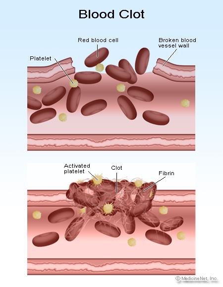 Platelets