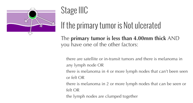 Stage III3 melanoma criteria